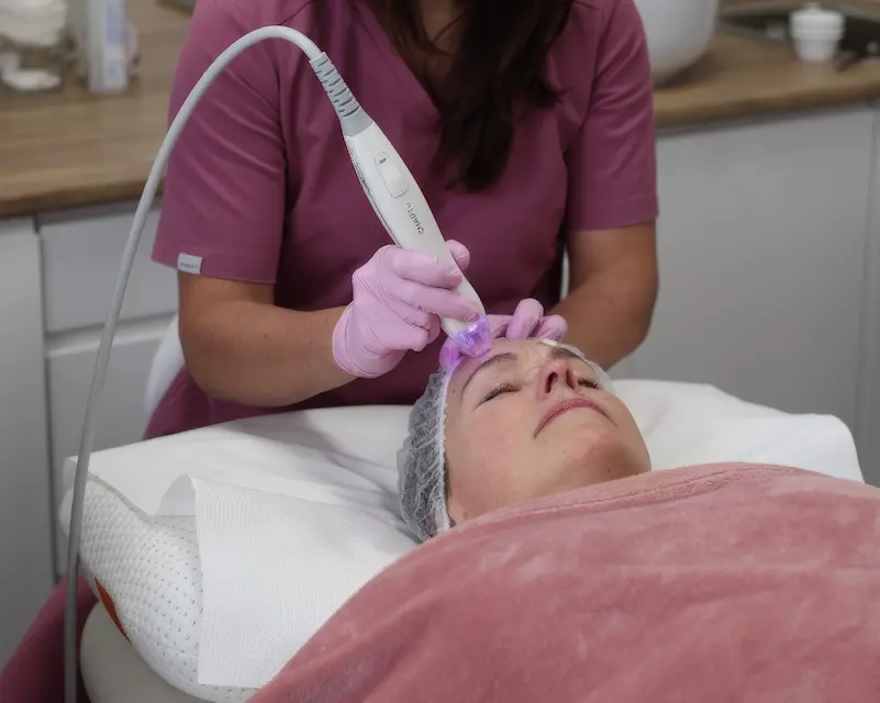 Radiofrekwencja mikroigłowa Virtue RF